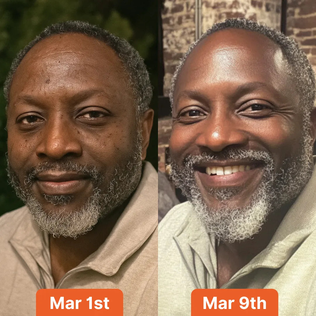 Anti-Dark Spots & Acne African Black Soap