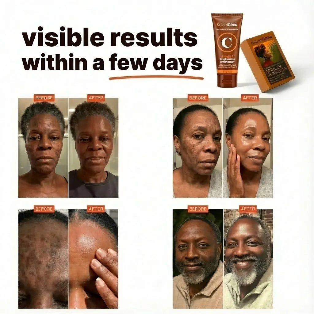 Anti-Dark Spot & Acne African Black Kit