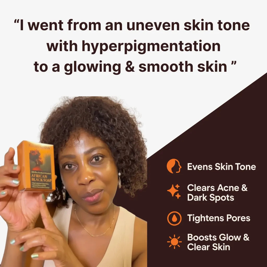 Anti-Dark Spots & Acne African Black Soap