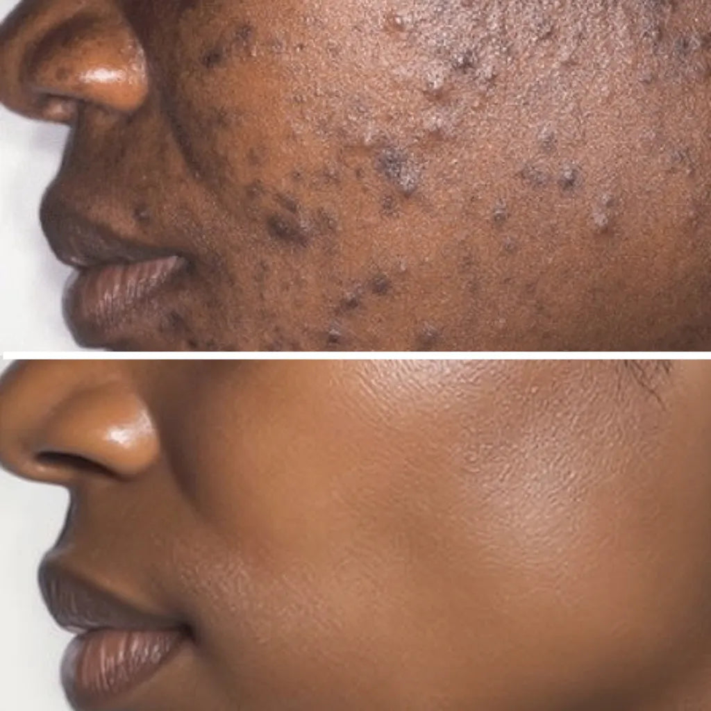 It Erases Dark Spots Like an Instagram Filter... But For Real