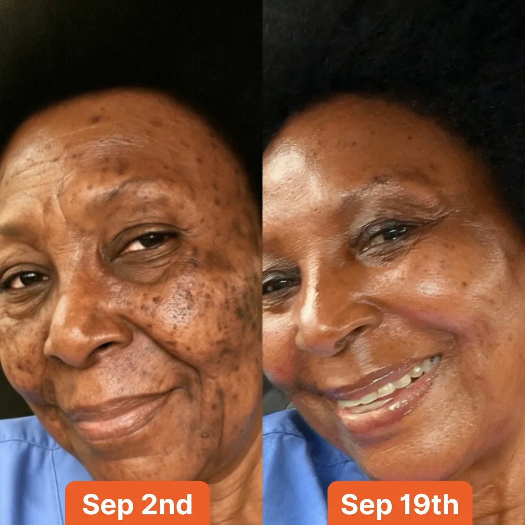 VISIBLE CHANGE IN 2 WEEKS