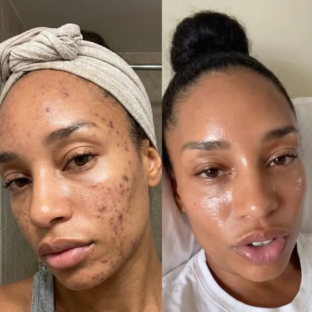 VISIBLE CHANGE IN 2 WEEKS